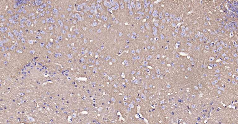 钠钾ATP酶蛋白a1即用型免疫组化试剂盒-IHC0259